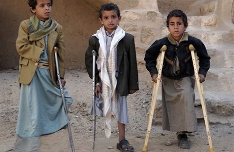 سازمان ملل یمن را مرکز رنج بشر امروز دانست